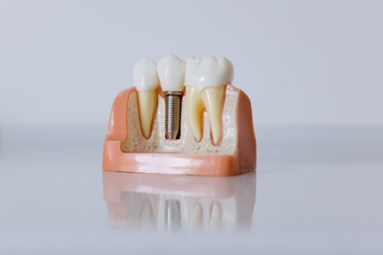 Implante dental unitario en Santa Coloma de Gramenet