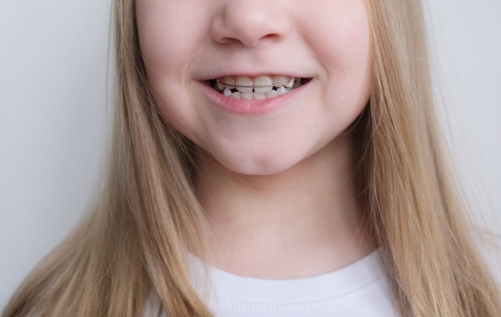 ortodoncia interceptiva en Santa Coloma de Gramenet