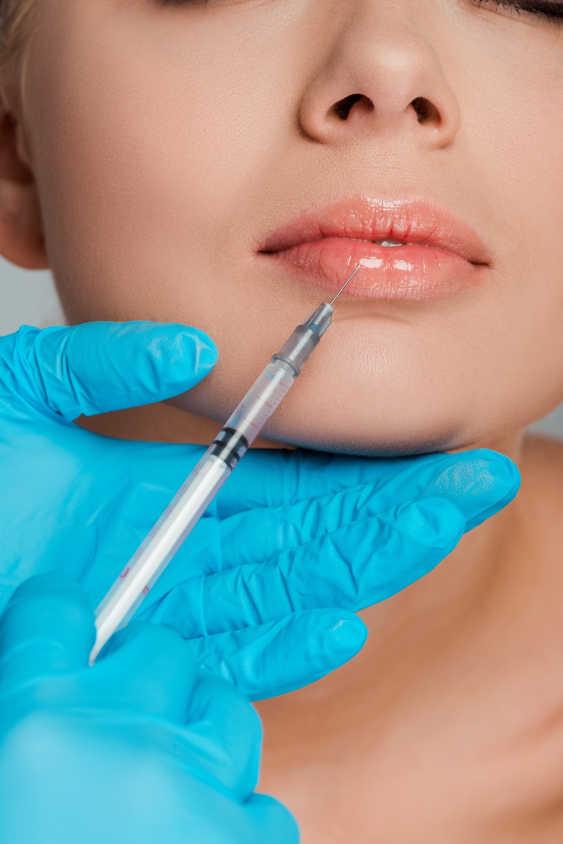 Tratamiento estético de relleno labial para labios hidratados y definidos