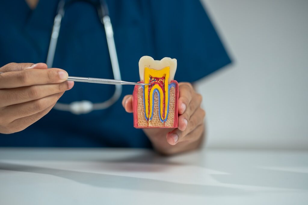 Tratamiento de endodoncia en Santa Coloma de Gramenet