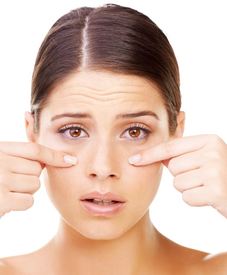 ojeras y mirada cansada tratamiento de ojeras