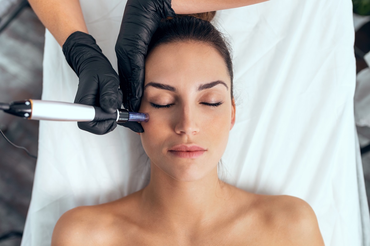 Tratamiento con dermapen