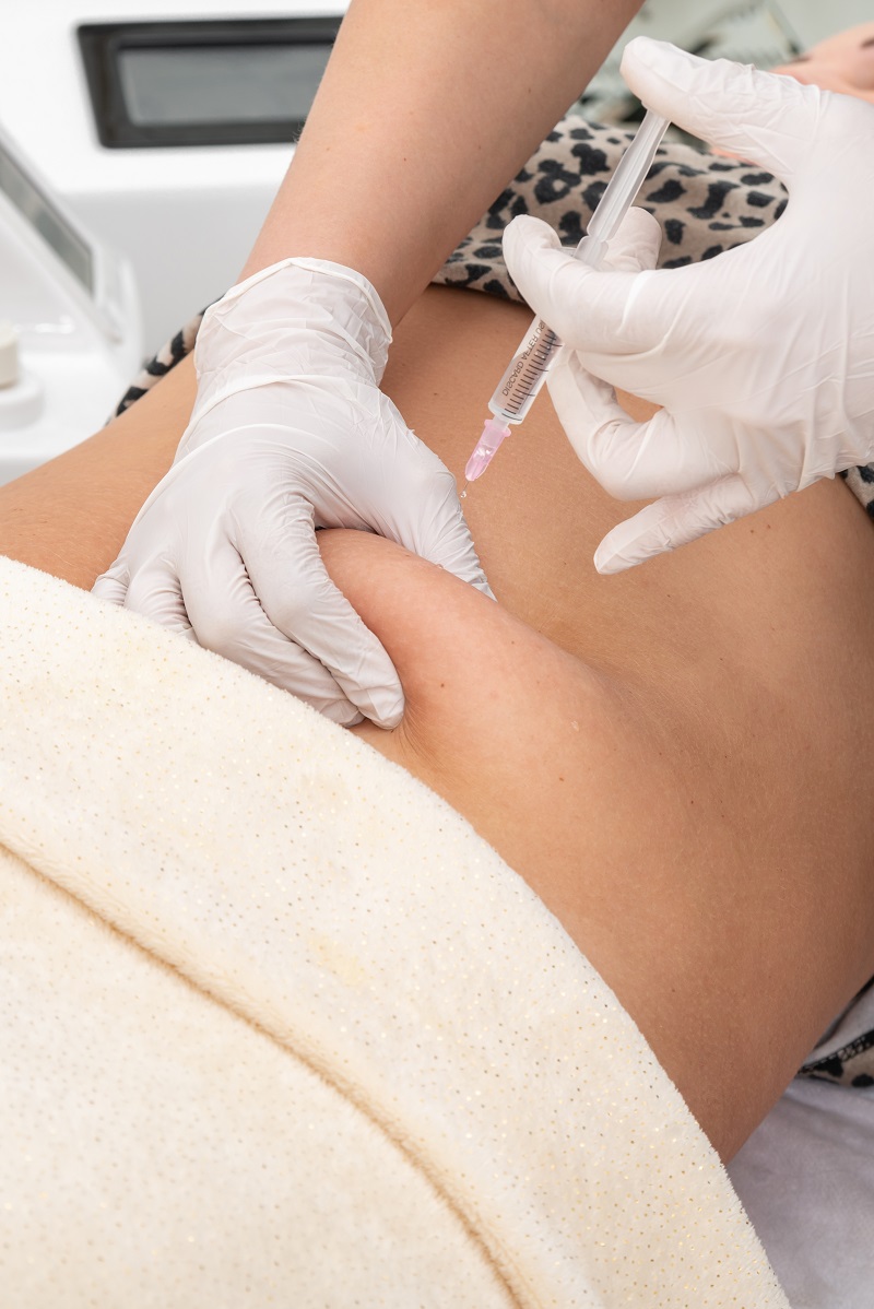 inyecciones de mesoterapia corporal en abdomen en Santa Coloma