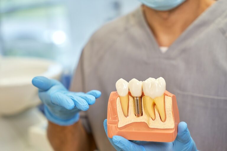 Implantes de carga inmediata en Santa Coloma de Gramenet