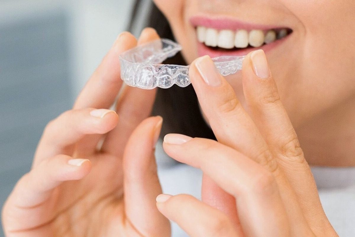 Retenedores después de la ortodoncia: por qué se mueven los dientes